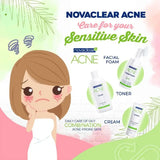 Novaclear Acne Kit With Acne Facial Foam 100ml + Acne Toner 150ml + Acne Cream For Oily, Combination & Acne-Prone Skin 40ml Novaclear