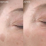 GlowBiotics Probiotic Advanced Vitamin C Brightening Anti-Aging Serum For All Skin Types 30ml GlowBiotics