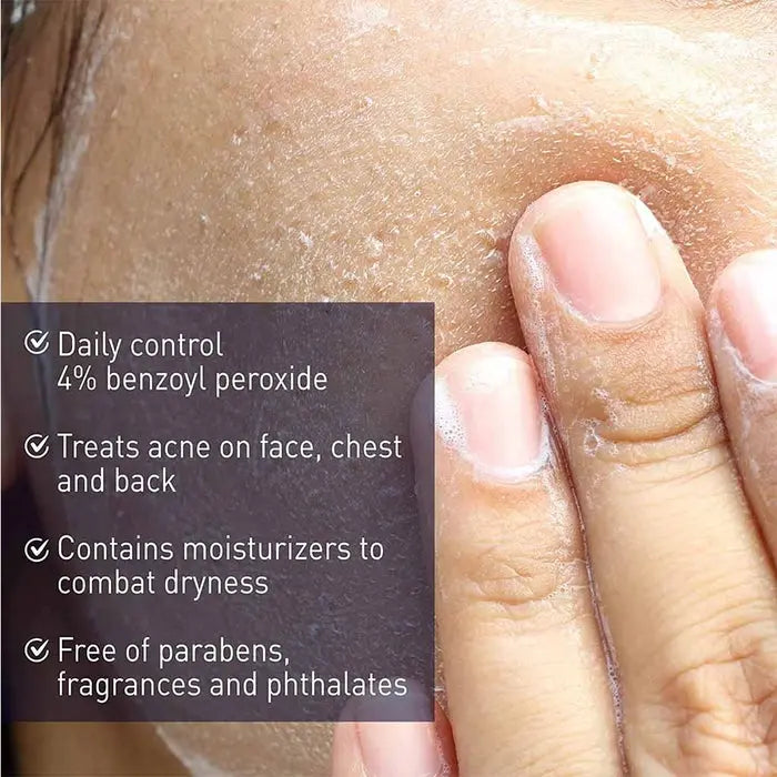 PanOxyl Acne Creamy Face & Body Wash With 4% Benzoyl Peroxide 170g Panoxyl