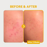Tirtir Pure Vitamin C 24 Skin Brightening Serum For Dark Spots 30ml Tirtir