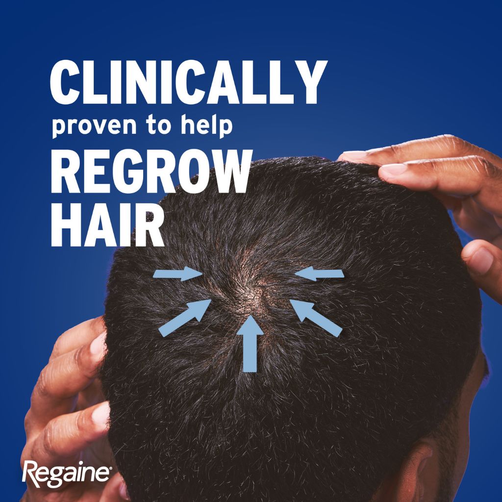Regaine For Men 5% Hair Regrowth Foam 73ml - 3 Pack (3 Month Supply) www.palcgcc.com