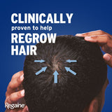 Regaine For Men 5% Hair Regrowth Foam 73ml - 3 Pack (3 Month Supply) www.palcgcc.com