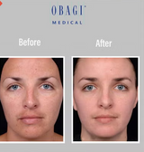 Obagi - C Fx C -Clarifying Skin Brightening Facial Serum With Vitamin C 30ml Obagi